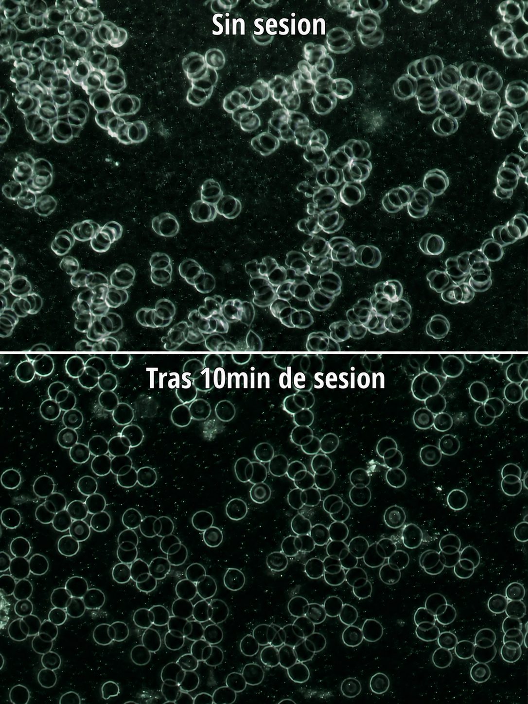Comparativa de sangre sin sesión y tras 10 minutos de sesión
